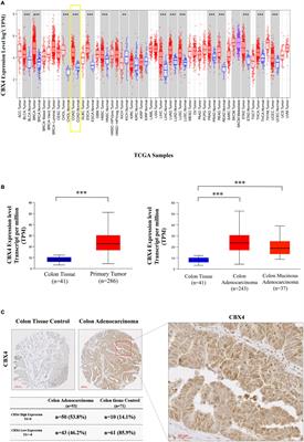 CBX4 Provides an Alternate Mode of Colon Cancer Development via Potential Influences on Circadian Rhythm and Immune Infiltration